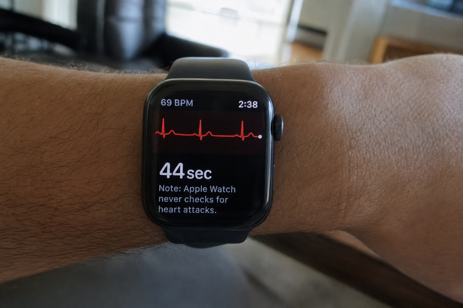 Apple Watch reddet 94 år gammel lege: Klokken oppdaget komplett hjerteblokk før han selv forsto hvor alvorlig det var