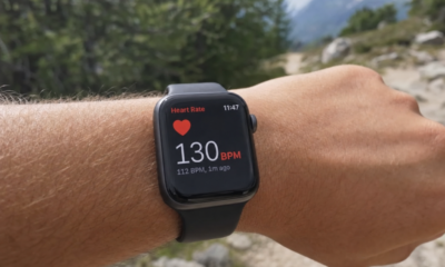 Smartklokken utløste panikk med feil hjertevarsel: Eksperter advarer mot helseangst fra wearables