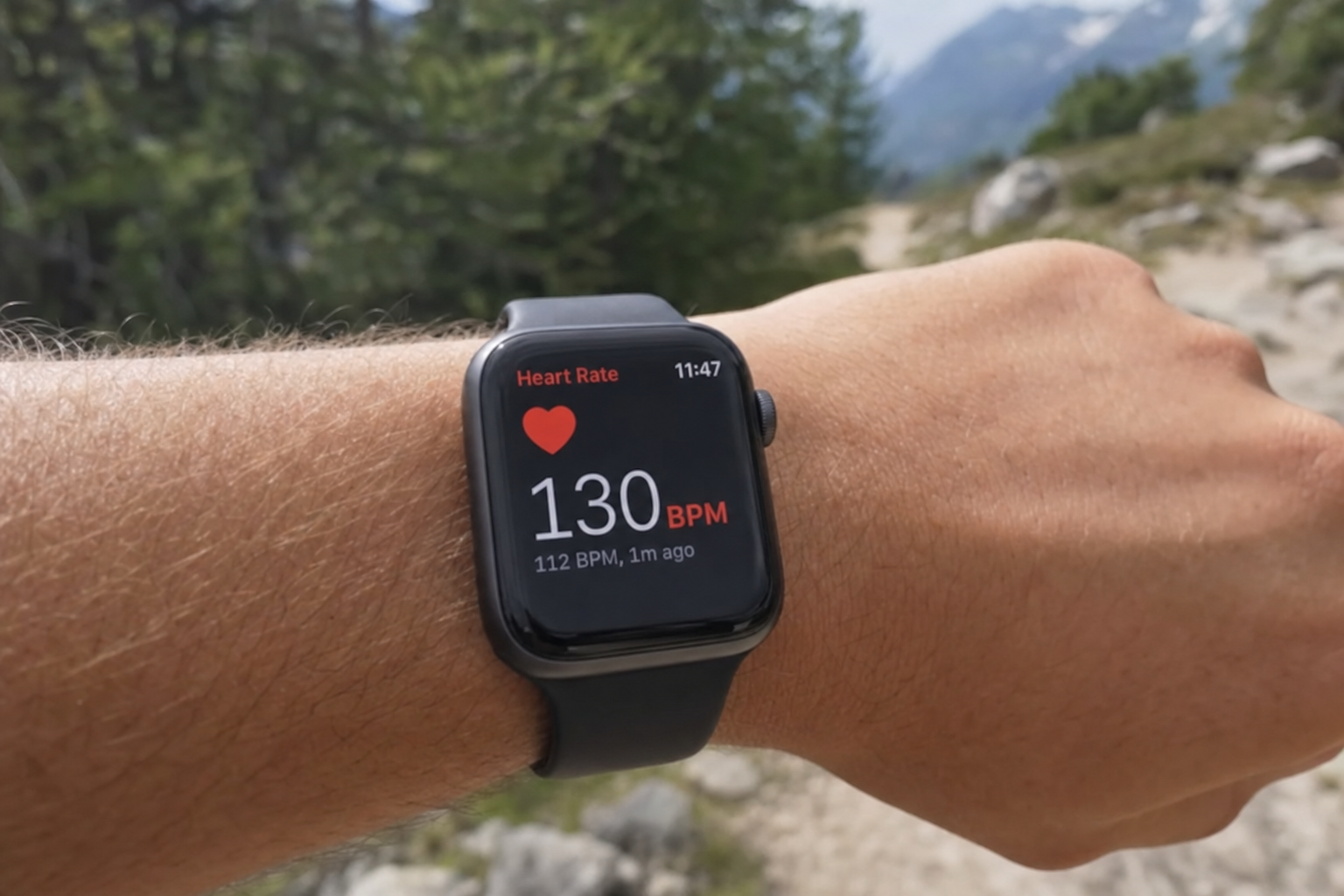 Smartklokken utløste panikk med feil hjertevarsel: Eksperter advarer mot helseangst fra wearables